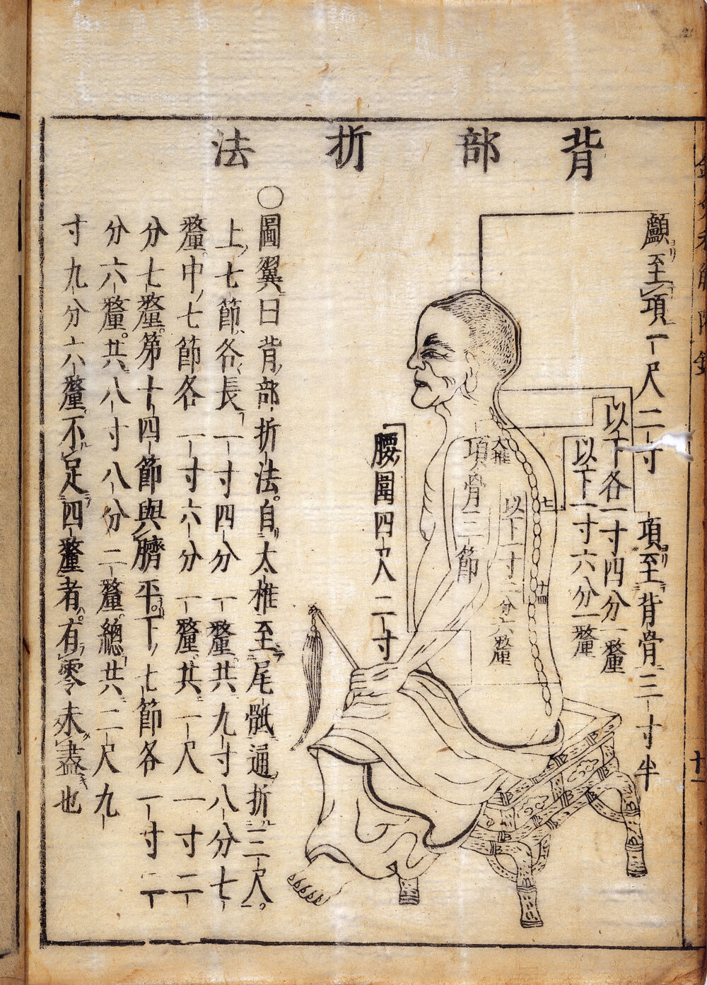 《十四经发挥》注本附录中的「背部折法」一页，木版